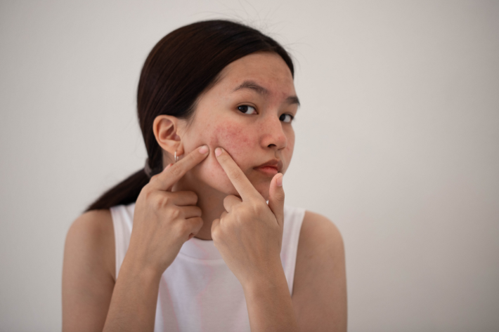 Ilustrasi facial wash untuk kulit berjerawat