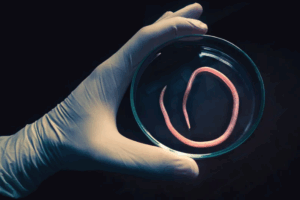 Ilustrasi cacing gelang/cacingan (Piola666/Gatty Images)